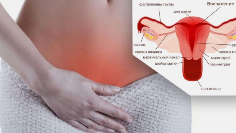 Воспаление по-женски: какие могут быть болезни?