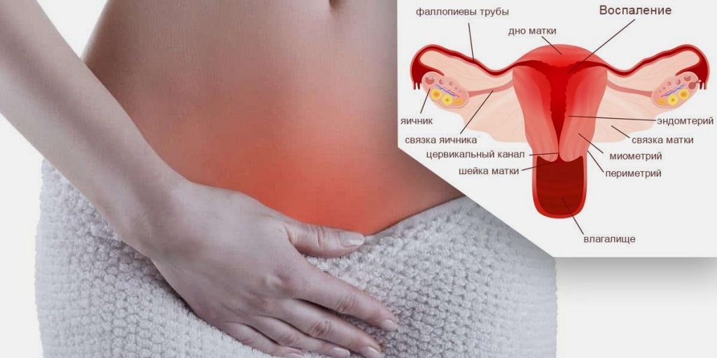 Воспаление по-женски: какие могут быть болезни?
