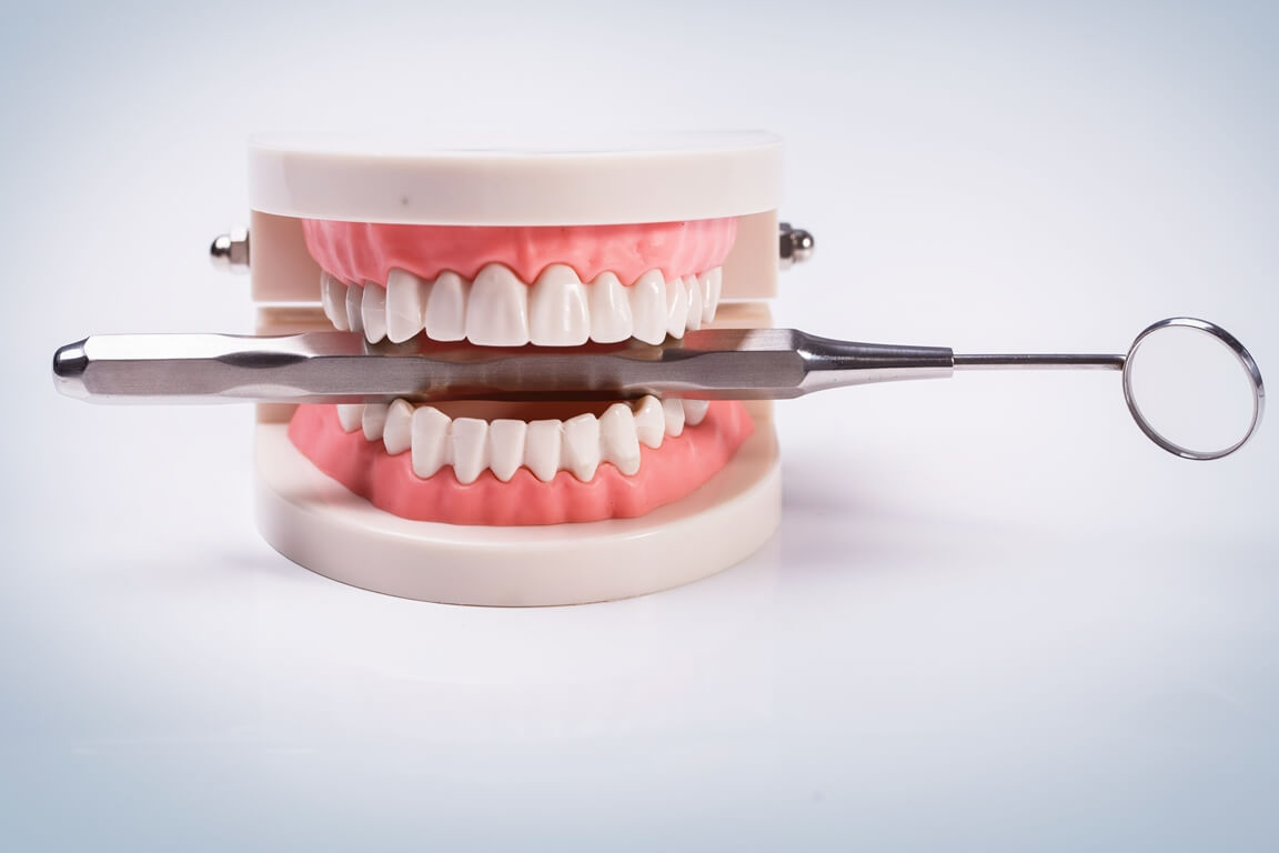 Как правильно выбрать зубные протезы?